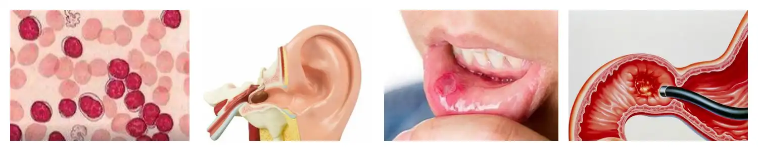 product-1-1 product-1-1