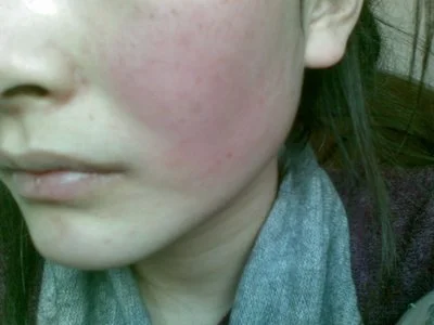 blog-400-300