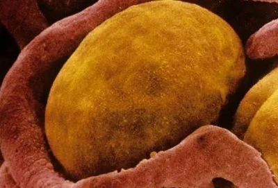 blog-400-271 blog-400-271