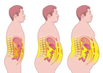 blog-400-285 blog-400-285