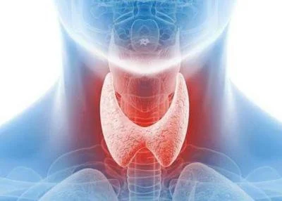 blog-400-286 blog-400-286