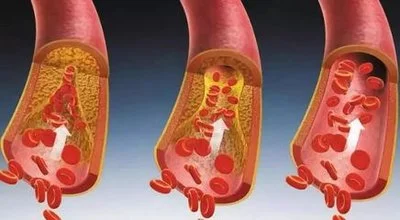 blog-400-220 blog-400-220