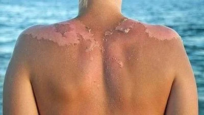 blog-400-225 blog-400-225