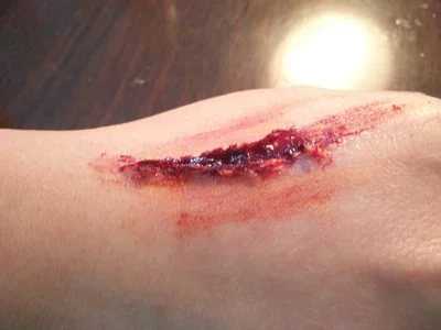 blog-400-300 blog-400-300