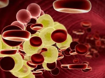 blog-400-300 blog-400-300