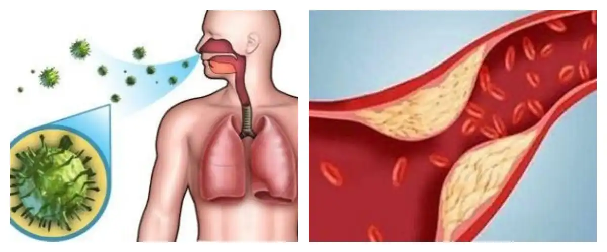 product-1-1 product-1-1