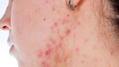 blog-400-225