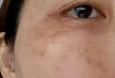 blog-400-271