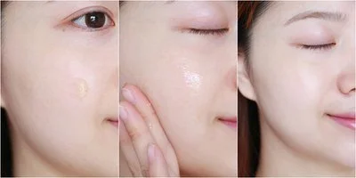 blog-400-200