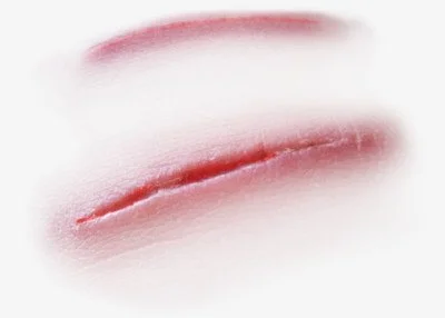 blog-400-286