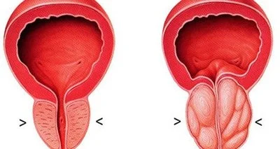 Health Benefits Health Benefits