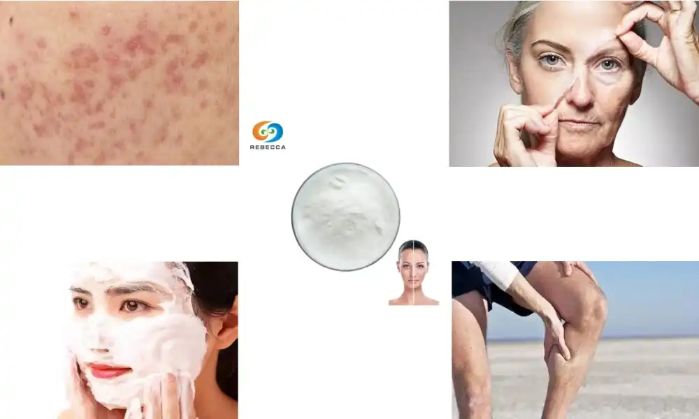 ಚರ್ಮ ಮತ್ತು ಸ್ವಾಸ್ಥ್ಯ ಉತ್ಪನ್ನಗಳಲ್ಲಿ ಕಡಿಮೆಯಾದ ಎಲ್-ಗ್ಲುಟಾಥಿಯೋನ್‌ನ ಉನ್ನತ ಉಪಯೋಗಗಳು