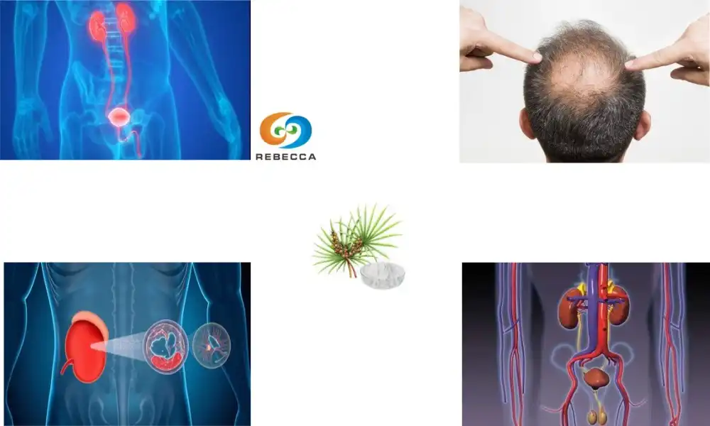 Quando tomar o pó de saw palmetto: de manhã ou à noite? Quando tomar o pó de saw palmetto: de manhã ou à noite?