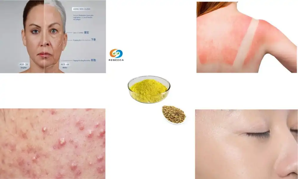 Why Kaempferol Powder Is the New Skincare Super Ingredient? Why Kaempferol Powder Is the New Skincare Super Ingredient?