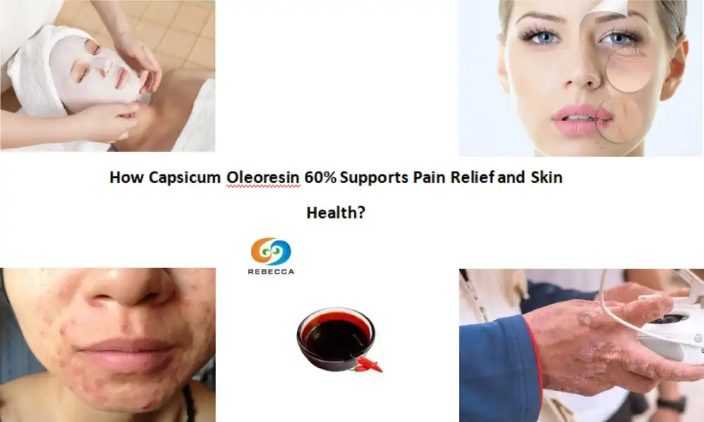 Як Capsicum Oleoresin 60% падтрымлівае абязбольванне і здароўе скуры?