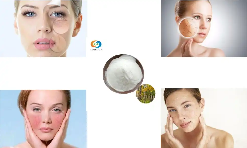 Letlalo le Hlakileng ka Tlhaho ka Birch Bark Extract Powder