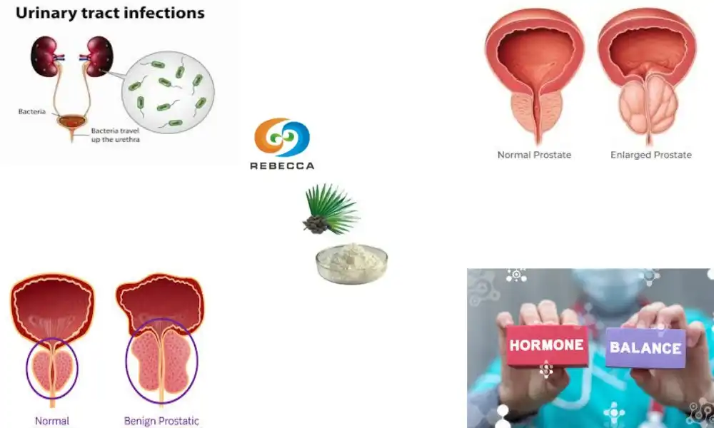 What is saw palmetto extract good for?