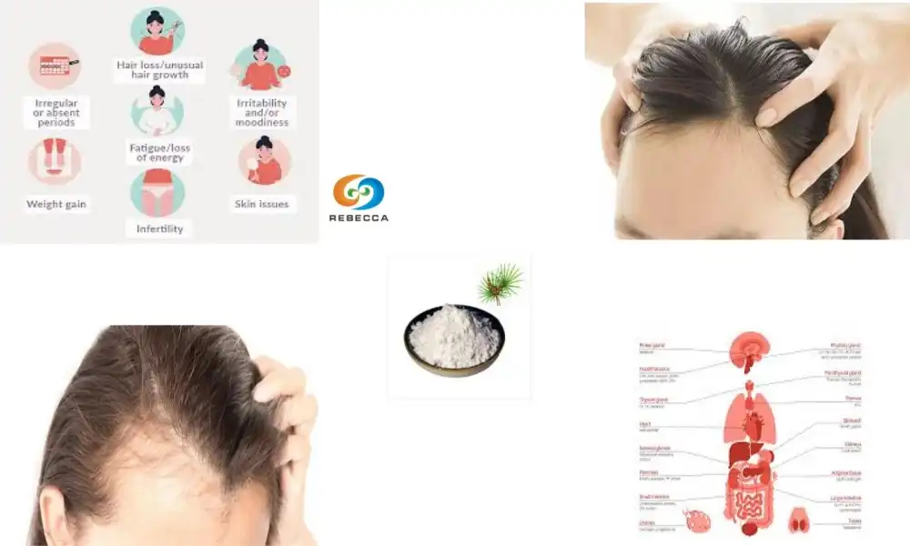 What Is the Right Saw Palmetto Dosage for Women?